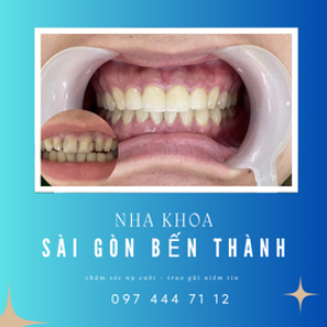Nha Khoa Sài Gòn Bến Thành – Chăm sóc nụ cười, trao gửi niềm tin