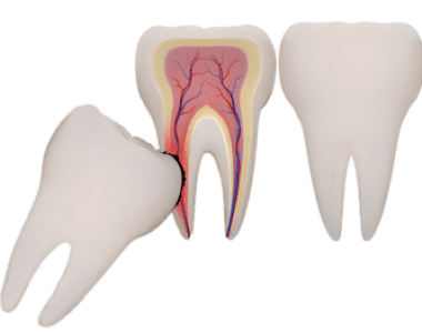 Dịch vụ nhổ răng khôn tại nha khoa Sài Gòn Bến Thành